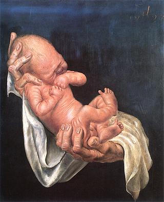 Newborn Baby on Hands (Ursus Dix)
